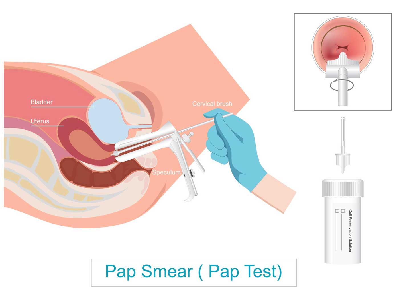 Pap Smear Testi Ankara